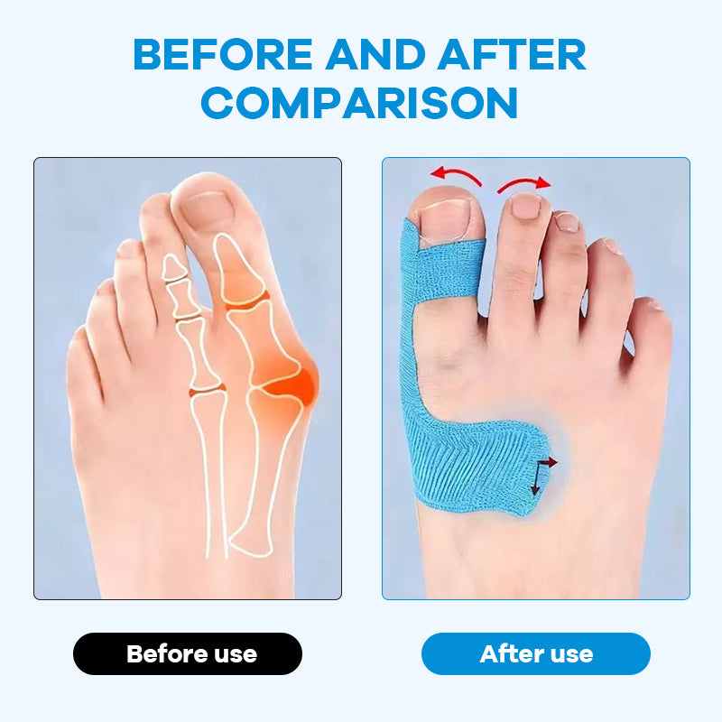 📢📢LAST DAY SALE 50% OFF🦶Pre-cut Bunion Corrector Kinesiology Tape